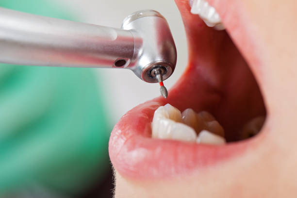 Best Same-Day Emergency Dentist in Sherwood Manor, CT